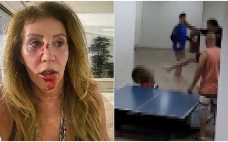 Mãe de agressor diz ter apanhado de vizinha que levou chute no rosto: ‘Meu filho me viu sangrando e foi tirar satisfação’