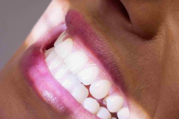 Conheça alguns mitos e verdades sobre ir ao dentista