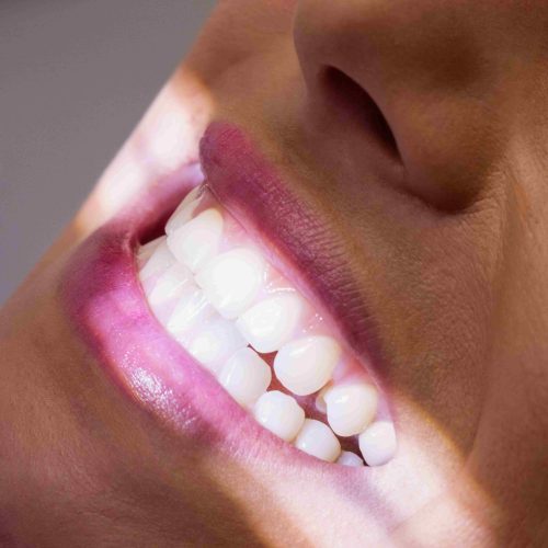 Conheça alguns mitos e verdades sobre ir ao dentista