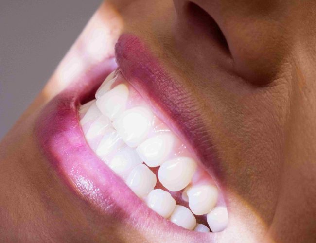 Conheça alguns mitos e verdades sobre ir ao dentista