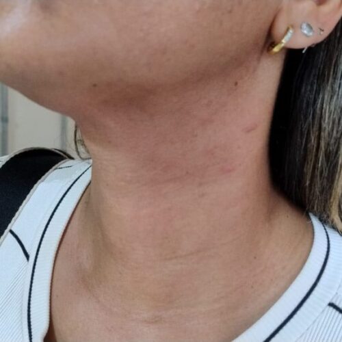 Denúncia: Mulher relata ameaças e agressões do ex-marido à polícia